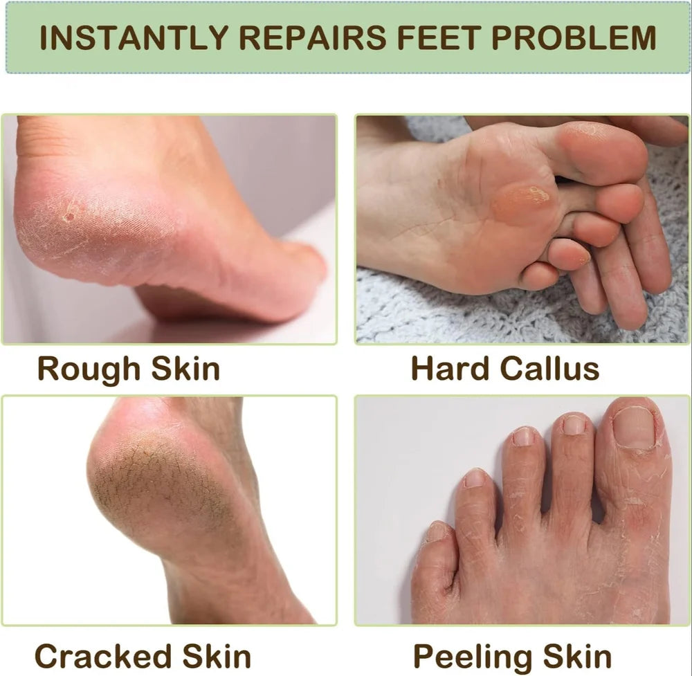 Spa Moisturizing Gel Socks For Dry Feet And Ankles